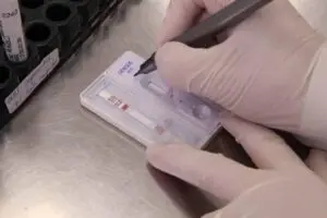 dengue
