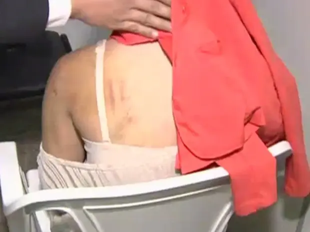 Adolescente de 14 anos levou socos, pauladas e facadas, em Trindade, Goiás (Foto: Reprodução/TV Anhanguera)