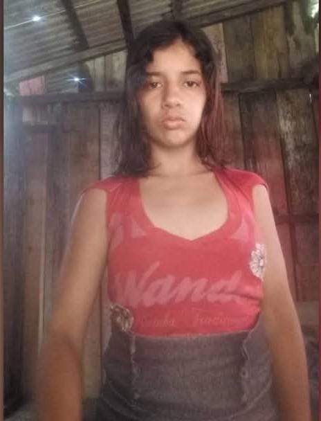 Adriana, vítima de atropelamento