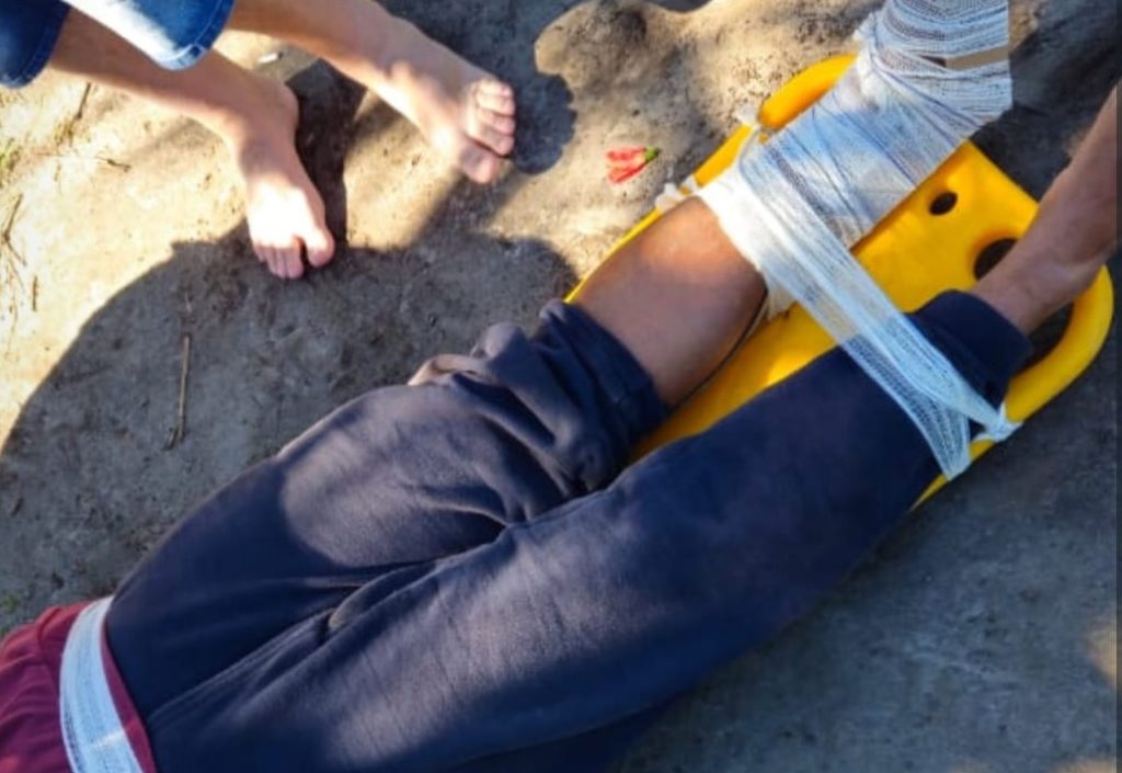 GCM gesgata mulher ferida em morro Ilha do Mel