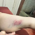 A vítima afirma que teve o braço apertado com força durante a confusão, o que teria causado hematomas. Foto: Redes Sociais