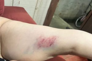 A vítima afirma que teve o braço apertado com força durante a confusão, o que teria causado hematomas. Foto: Redes Sociais